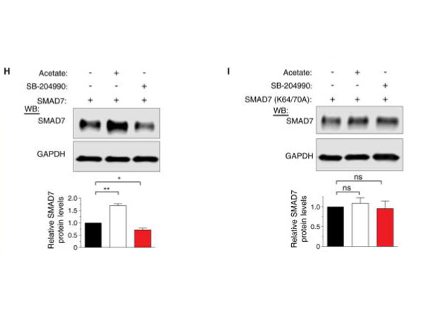 Western blot using Fluorescent TrueBlot®: Anti-Rabbit IgG DyLight™ 800